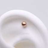 Detail View 1 of Implant Grade Titanium OneFit Threadless Rose Gold Ball Top Part