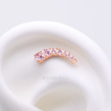 Detail View 1 of Implant Grade Titanium OneFit Threadless Rose Gold Sparkle Journey Curve Essence Top Part-Pink